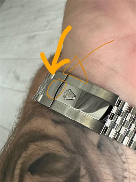 scratches on rolex bracelet